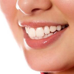 遗传性黄牙一般美白多少钱